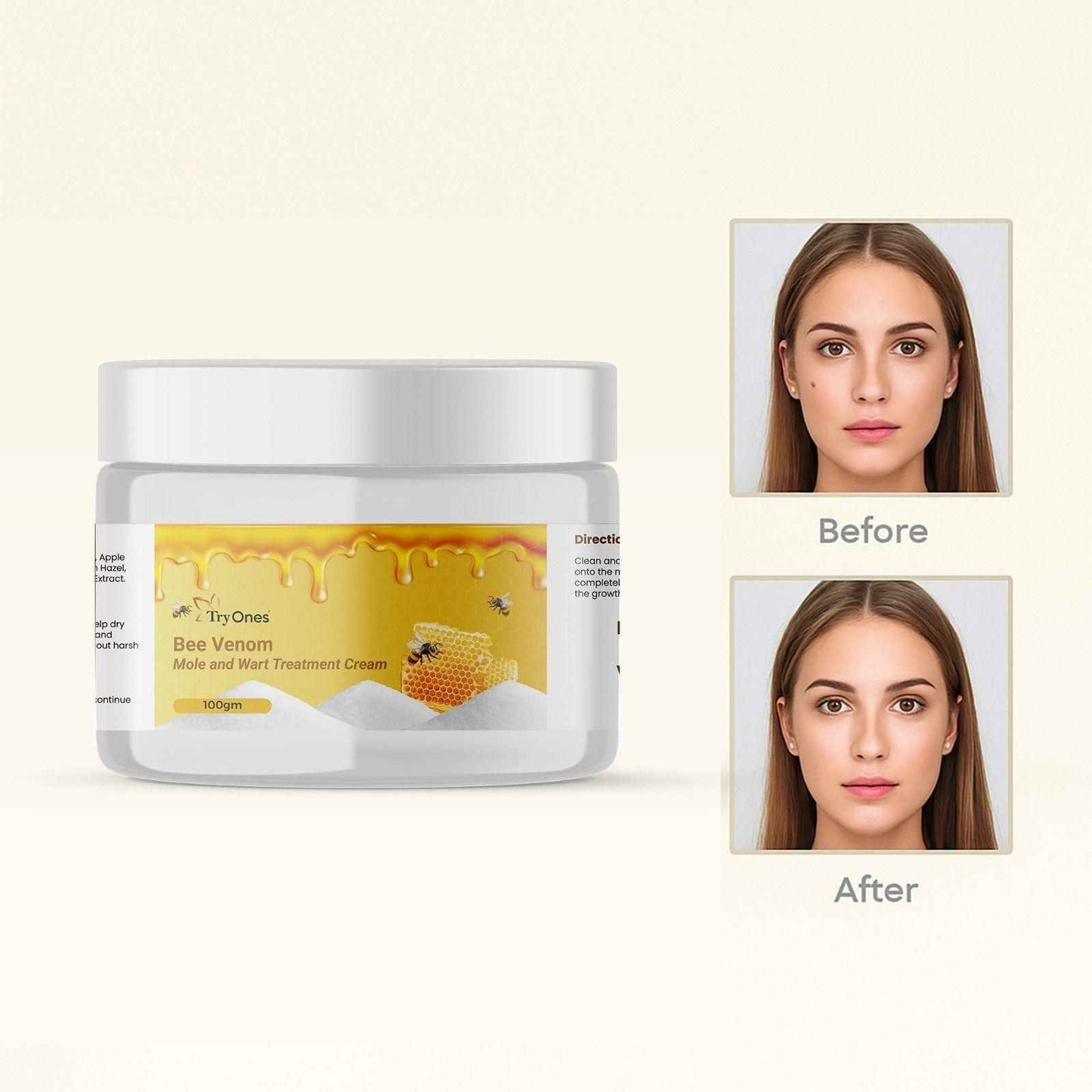 Bee Venom Mole and Wart Treatment Cream 200 gm Pack of 2